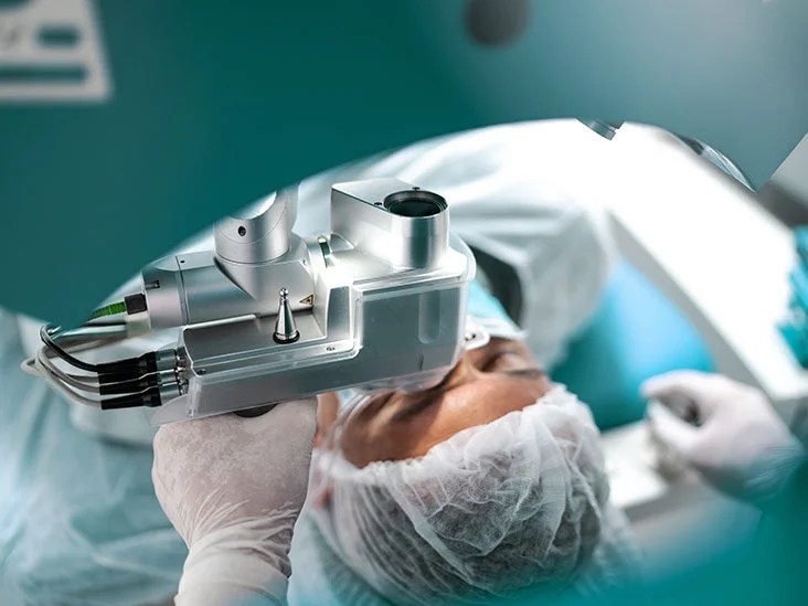 How Long Should I Rest My Eyes After Prk Surgery? The Washington Note