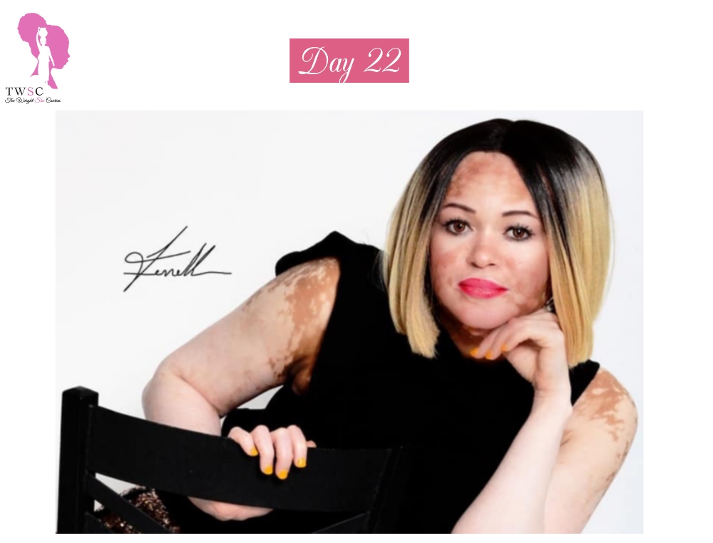 BodyPositivity Day 22 “You can Accept me for who I am or Keep it