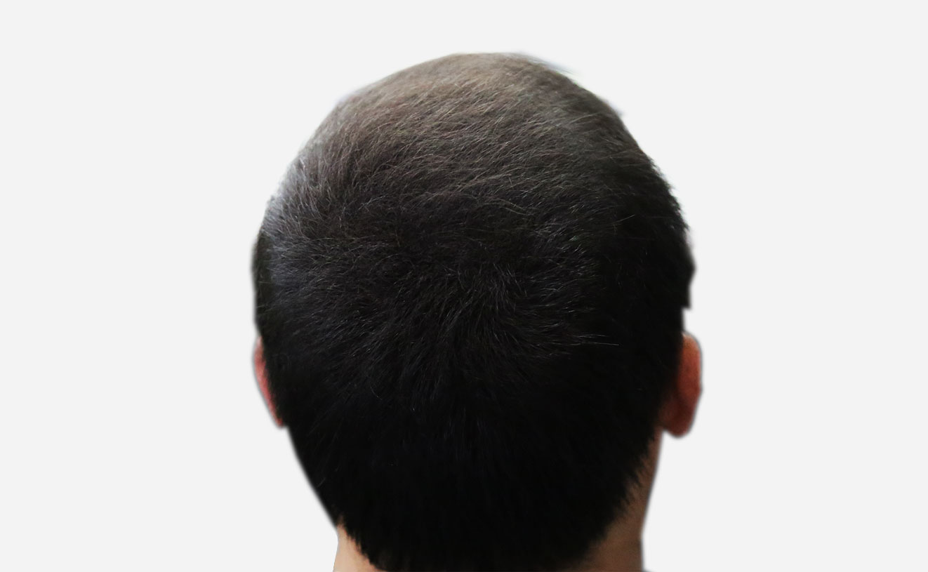 Thick Fiber Hair Building Fiber