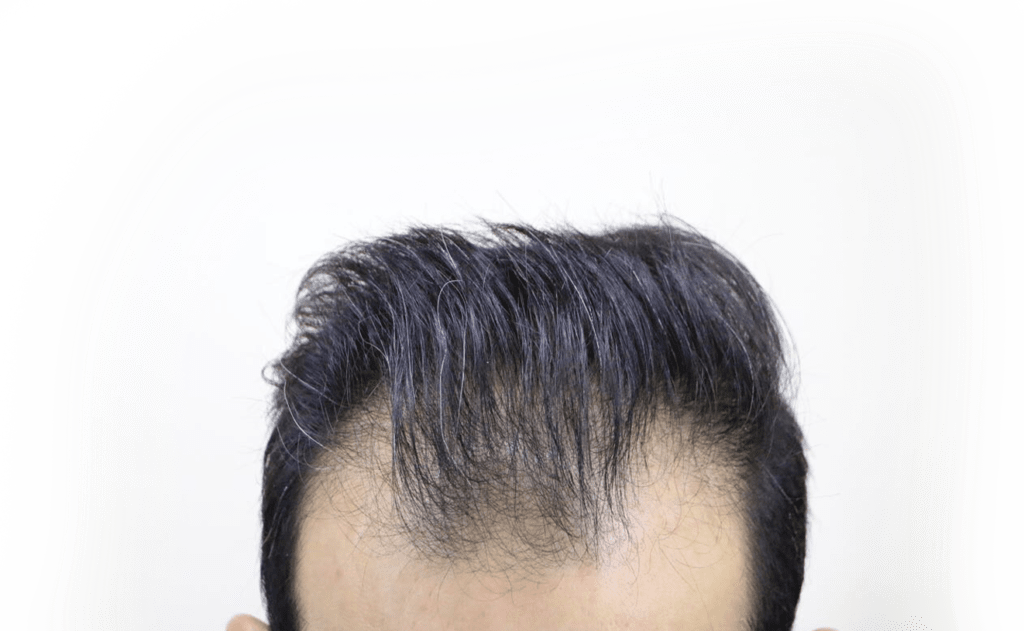 Thick Fiber Hair Building Fiber