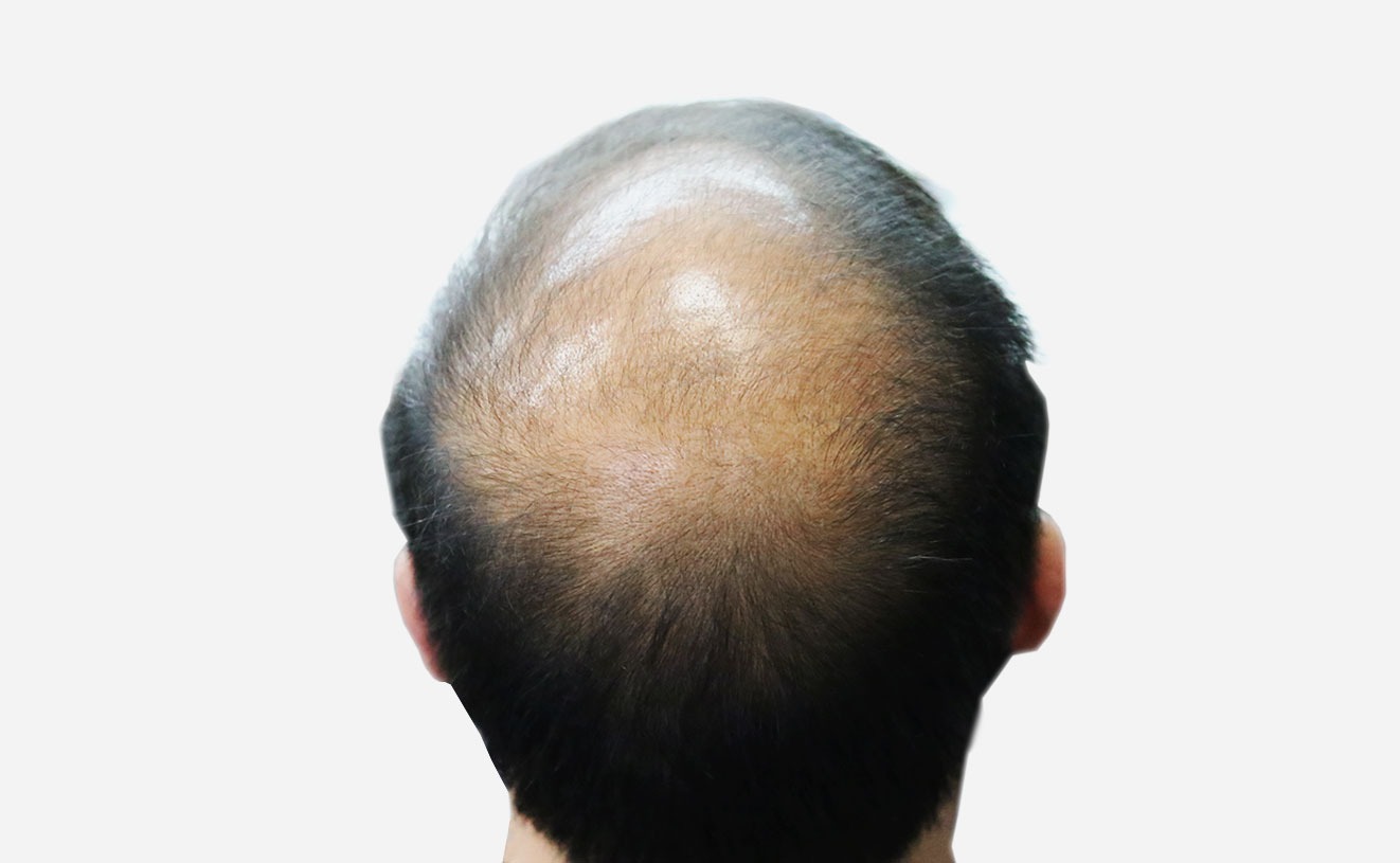 Thick Fiber Hair Building Fiber