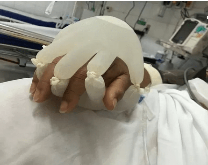 “La main de Dieu” l’astuce des infirmières brésiliennes pour