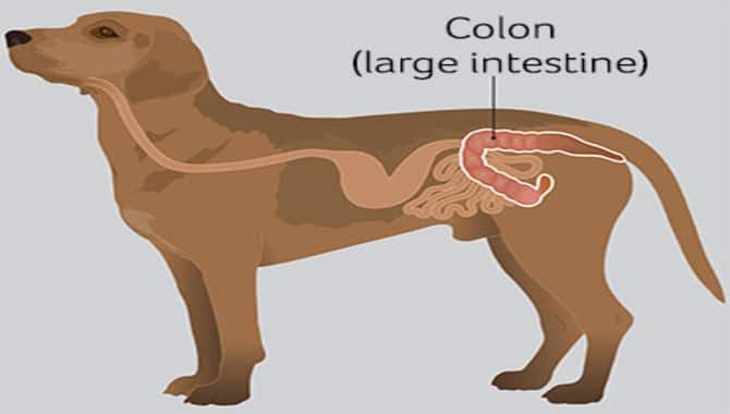 Colitis