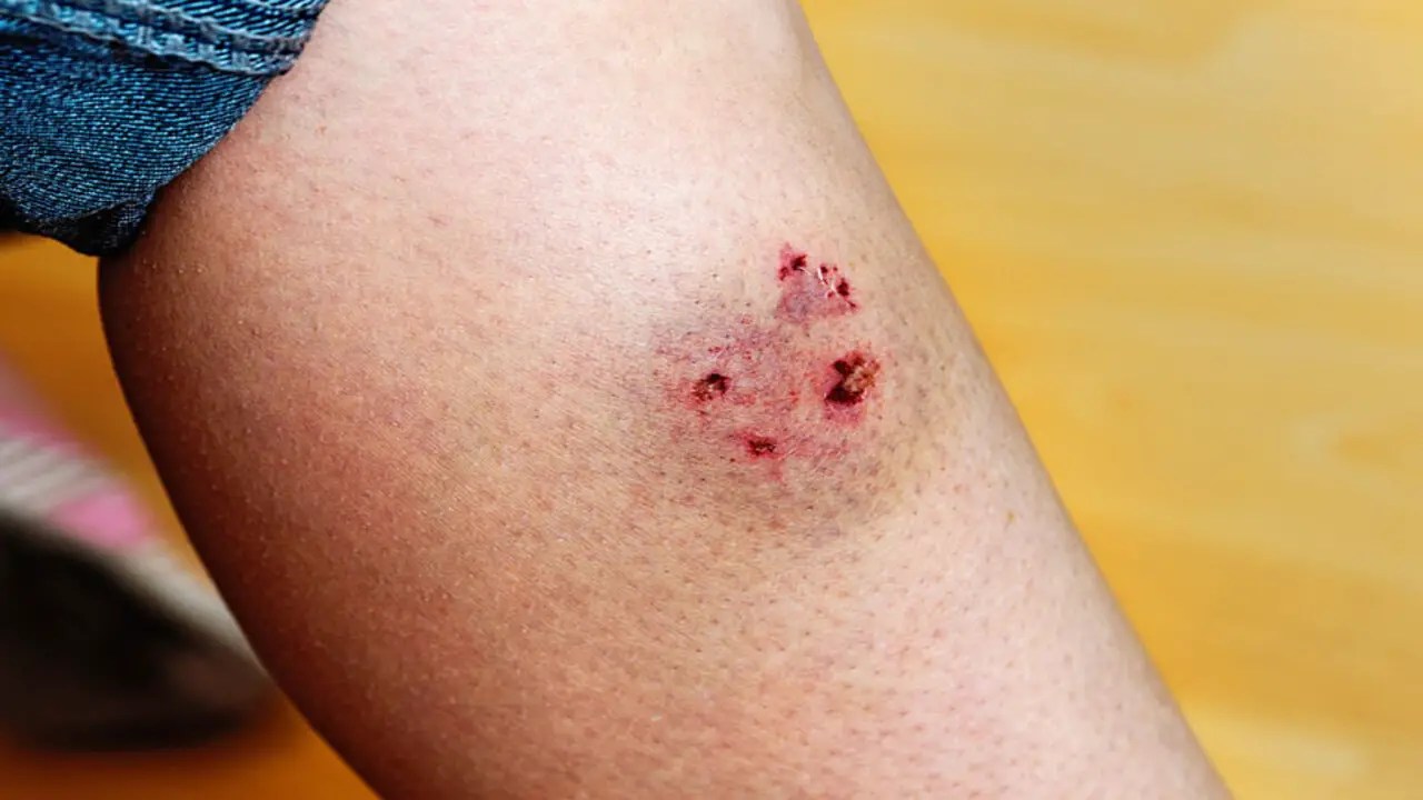 What Not To Do If The Dog Bites
