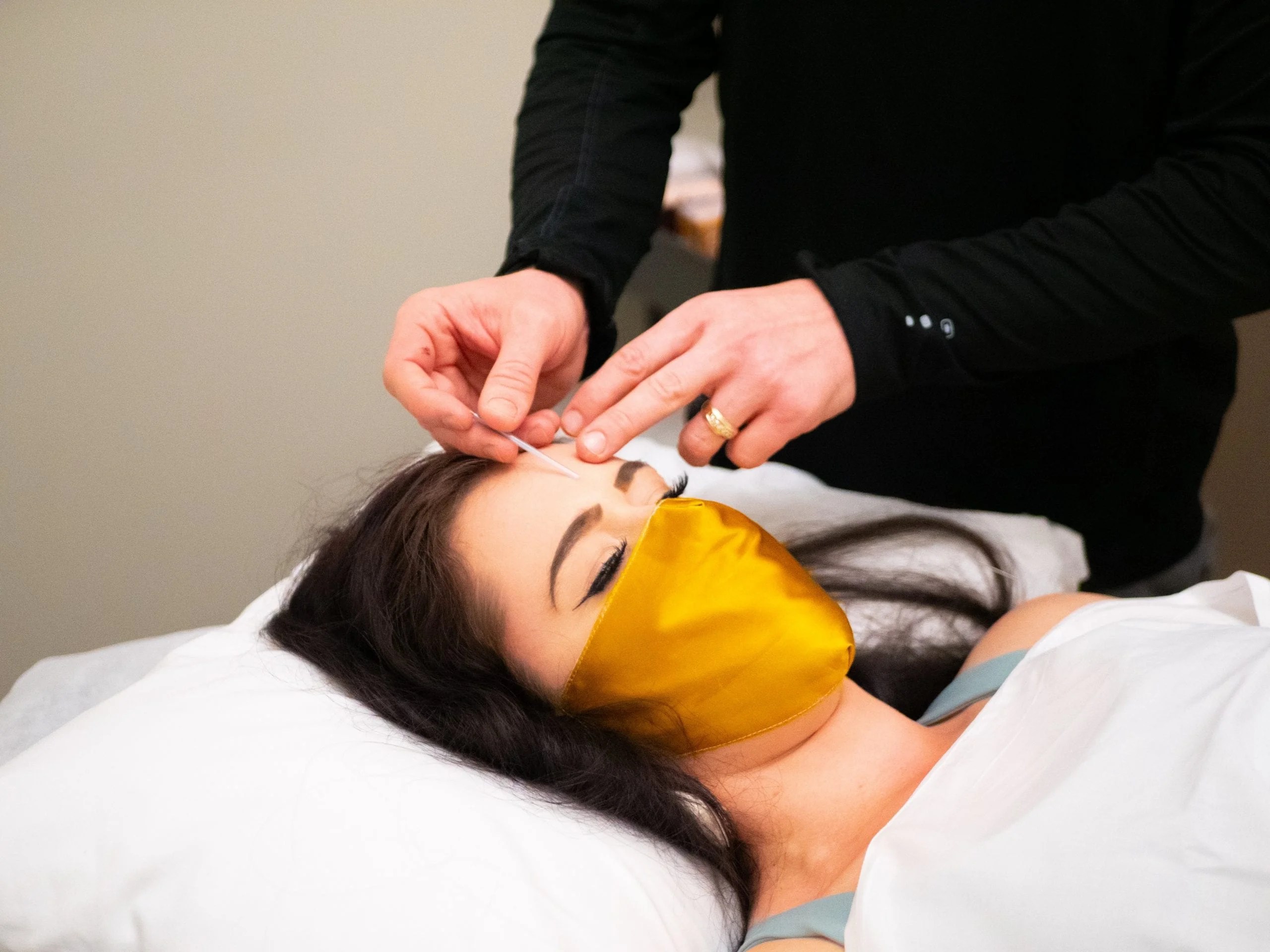 Why Acupuncture Should Be Part Of Your Selfcare Routine Vida