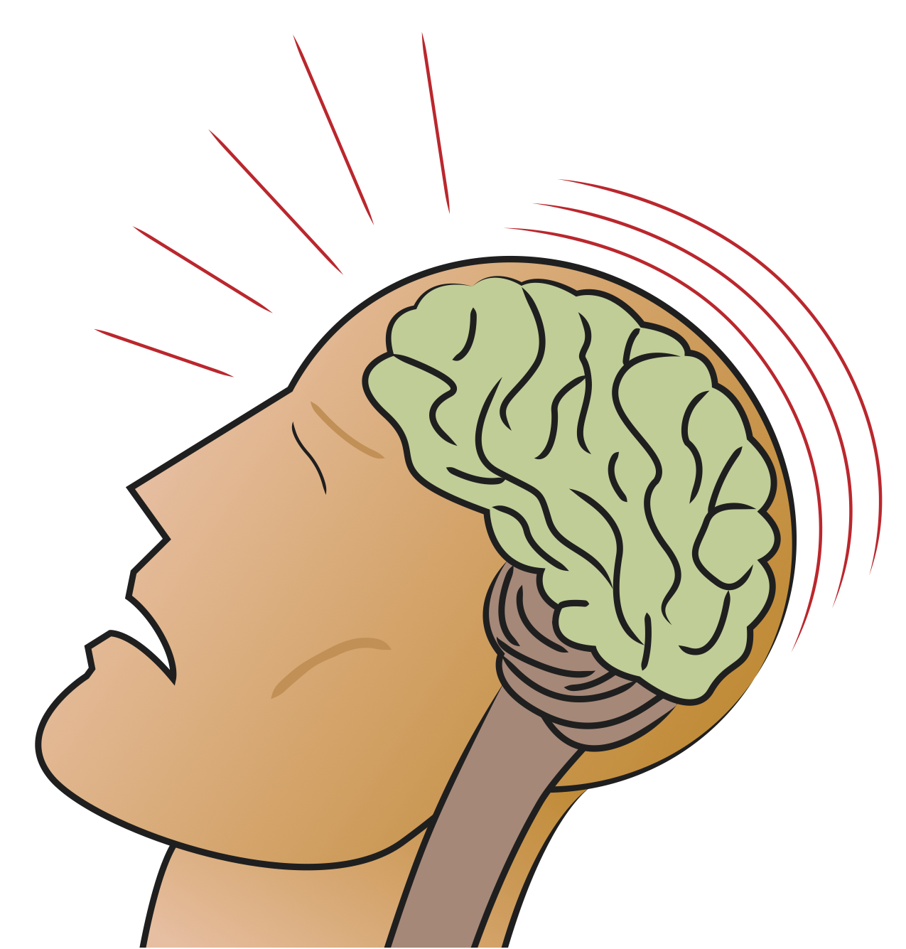 Information on Head Injury & Head Trauma thirdAGE