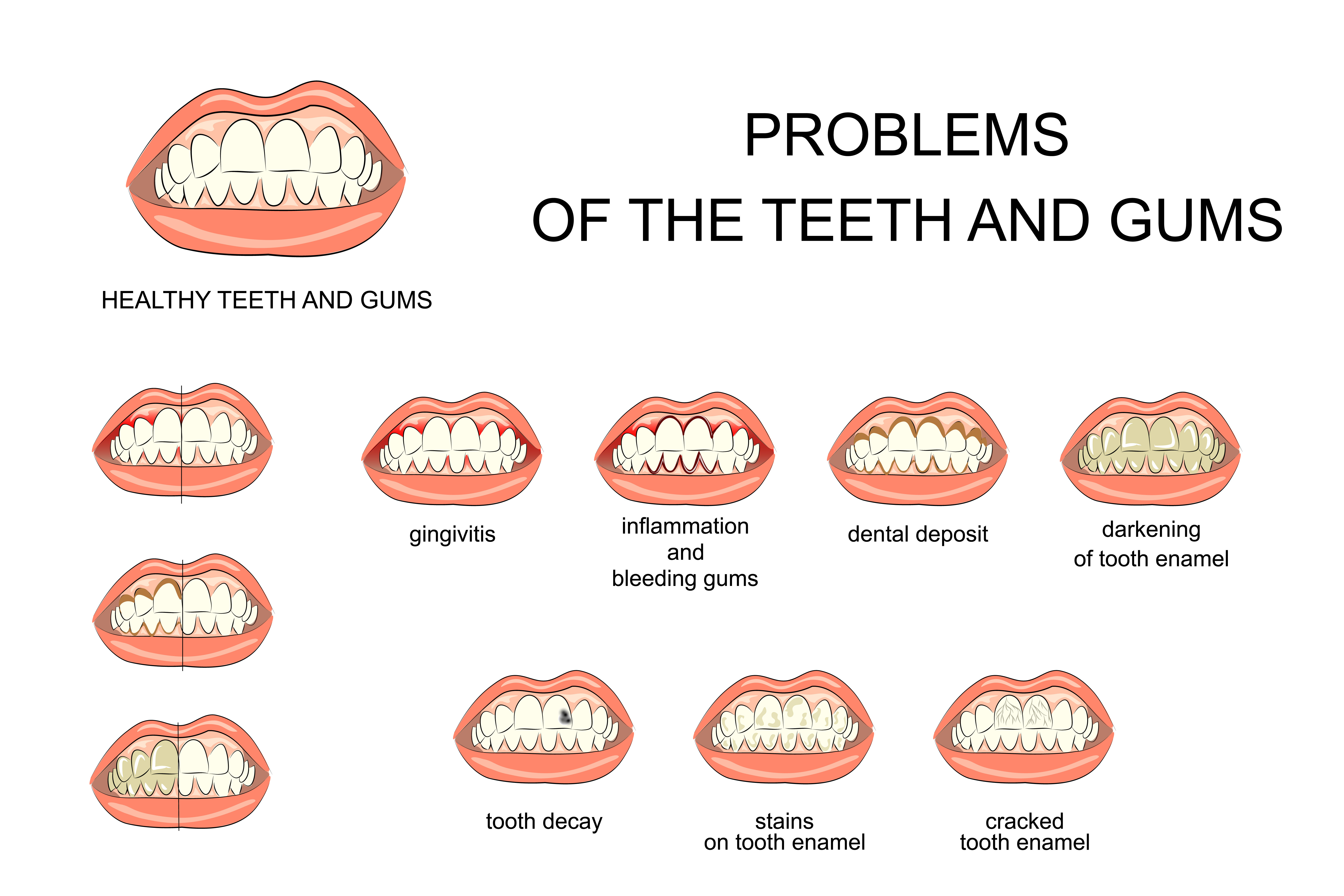 Tooth trouble Many MiddleAged Adults Report Dental Pain