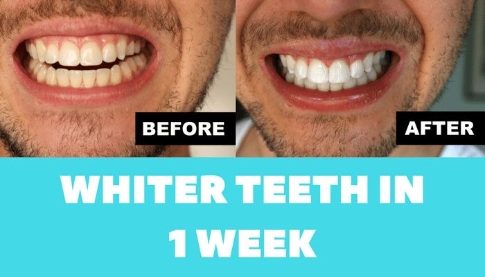 whiteteethpostcover21 Thomas In Action