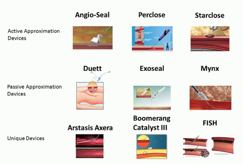 Access Management Including Closure Devices Thoracic Key