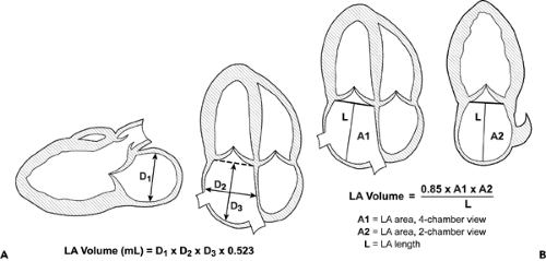 Assessment of Systolic Function and Quantification of Cardiac Chambers