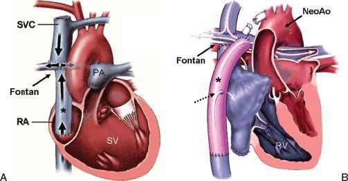Echocardiographic Evaluation of the Functionally