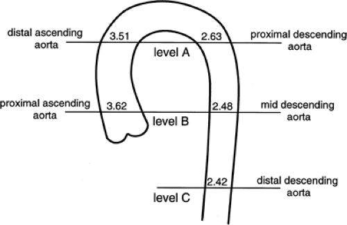 Aorta, Arch Vessels, and Great Veins | Thoracic Key
