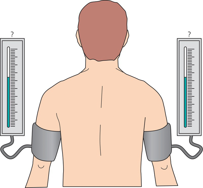 Blood pressure measurement Thoracic Key