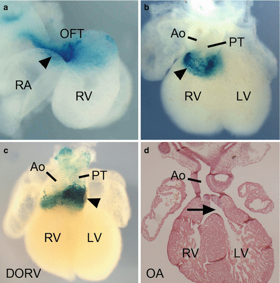 Molecular Pathways and Animal Models of Tetralogy of Fallot and Double Molecular Pathways and Animal Models of Tetralogy of Fallot and Double