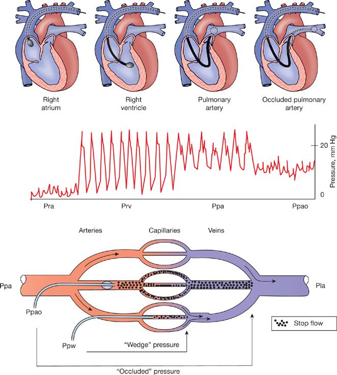 Pulmonary Circulation Thoracic Key Pulmonary Circulation Thoracic Key
