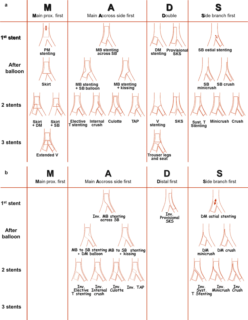 The Transradial Approach for Bifurcation Lesions | Thoracic Key