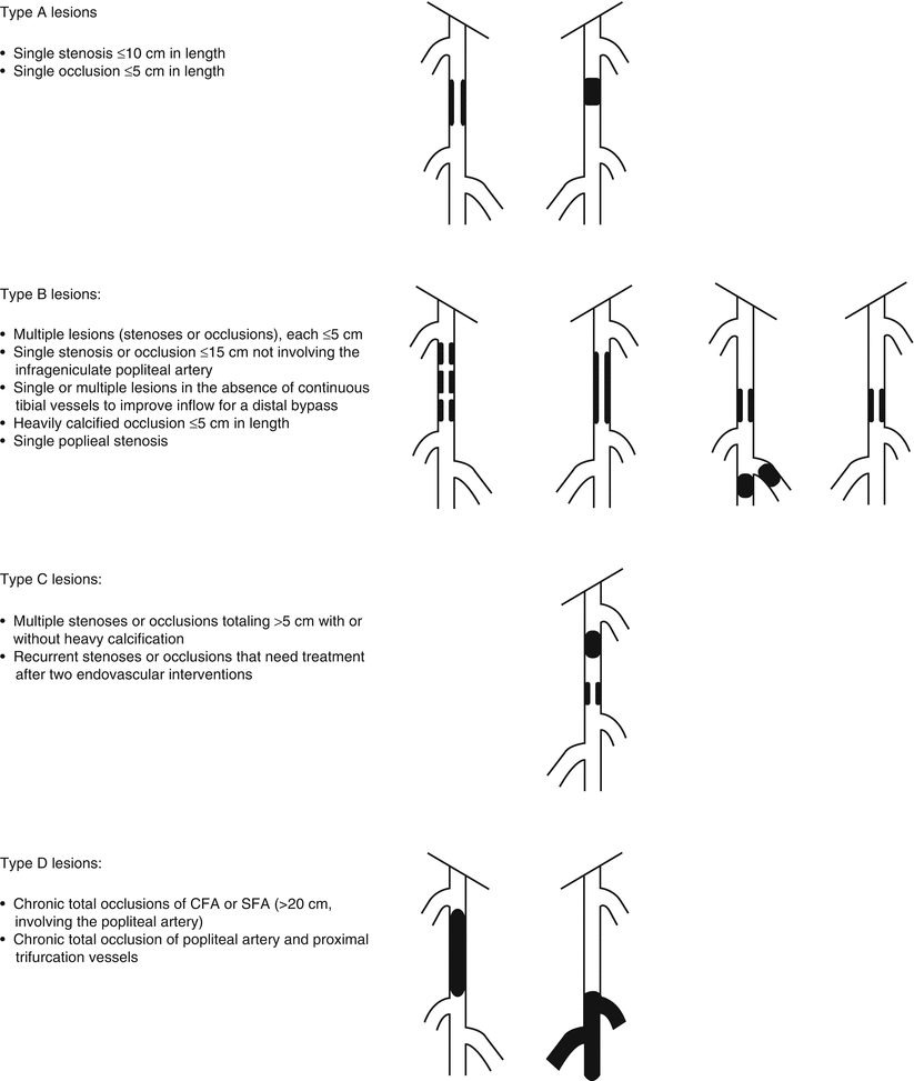 Overview of Peripheral Arterial Disease of the Lower Extremity ...