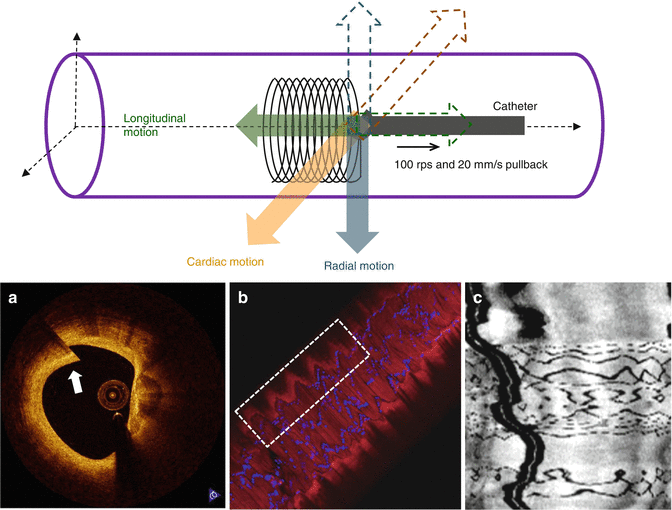 Physical Principles and Equipment of Intravascular Optical Coherence
