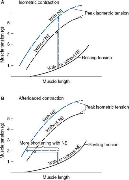 pix Contractile Cardiac Muscle Cell Action Potential characteristics of cardiac muscle cells