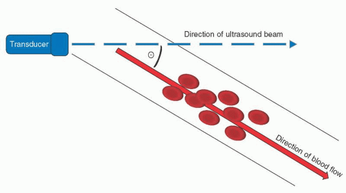 Doppler Shift Principles | Thoracic Key