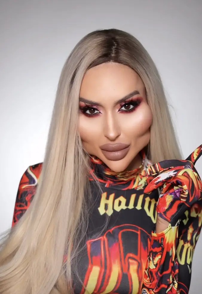 Woman With 'World's Largest Cheeks' Responds To Criticism Over Her New Look(03)