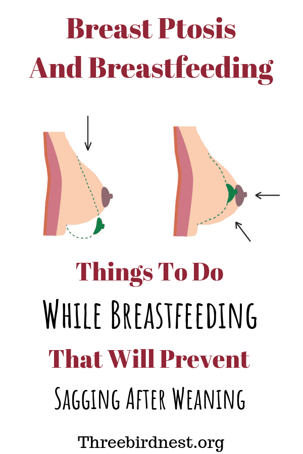 7 Things You Can Do To Prevent Sagging Breasts After Breastfeeding