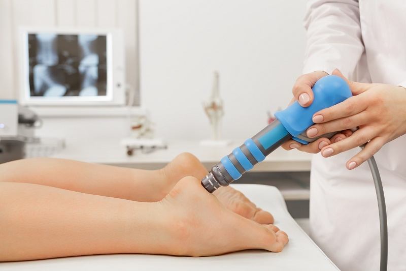 Shockwave Therapy for Plantar Fasciitis Thrive Now Physiotherapy