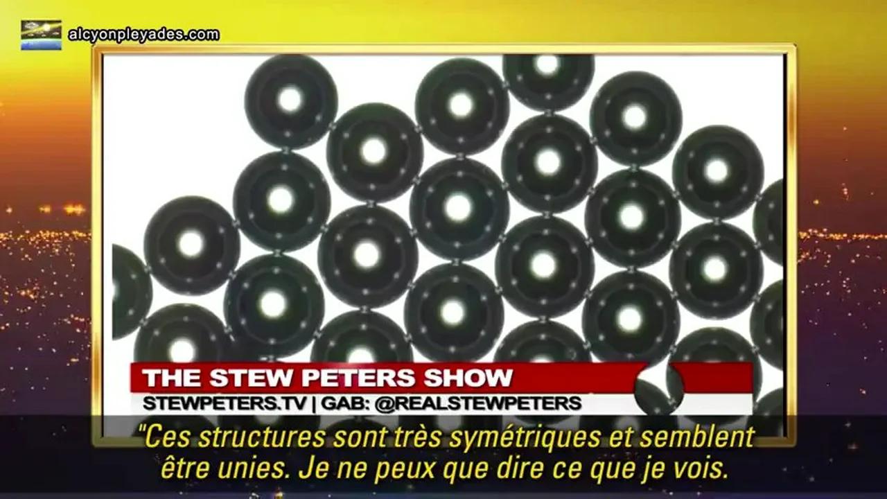 Des disques noirs dans le sang des injectés Dr Zandre Botha chez Stew