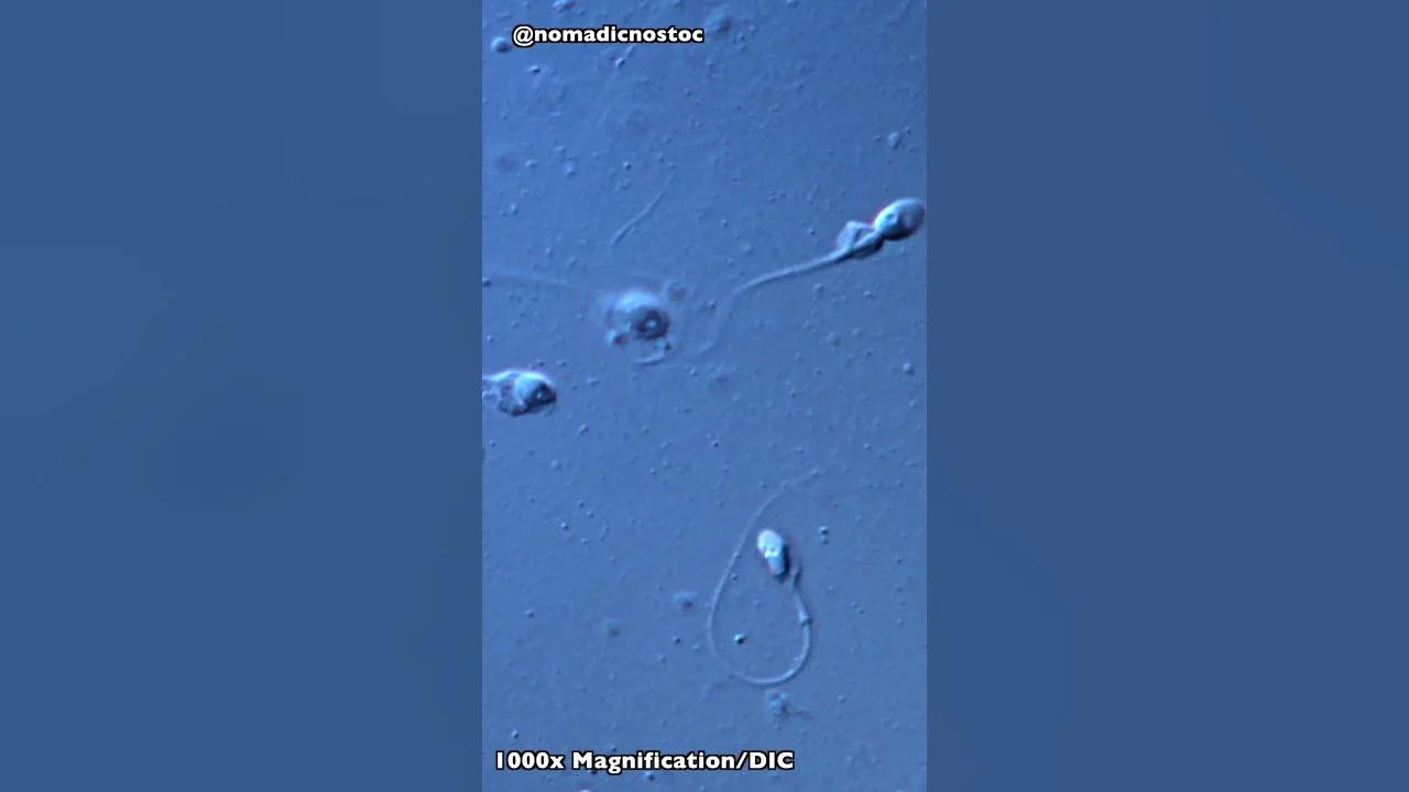 Human Sperm under the Microscope shorts