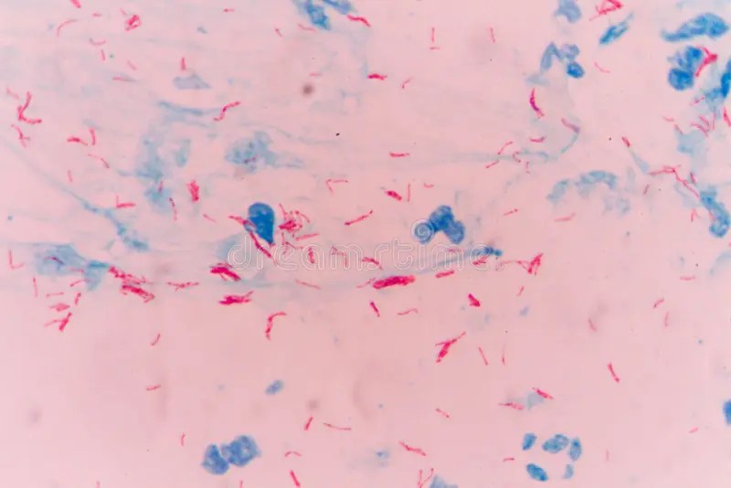 Mycobacterium tuberculosis stock image. Image of microbiology 80362283