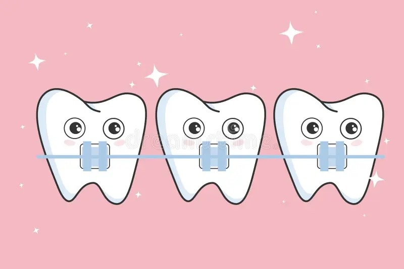 Cute Teeth with Metal Braces Stock Vector Illustration of kidsteeth, vector 192690446