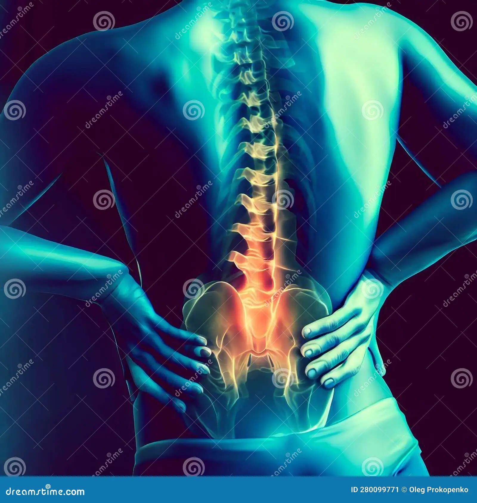 Back Problems, Pain, Sciatica, Spine Stock Illustration Illustration of spine, ache 280099771