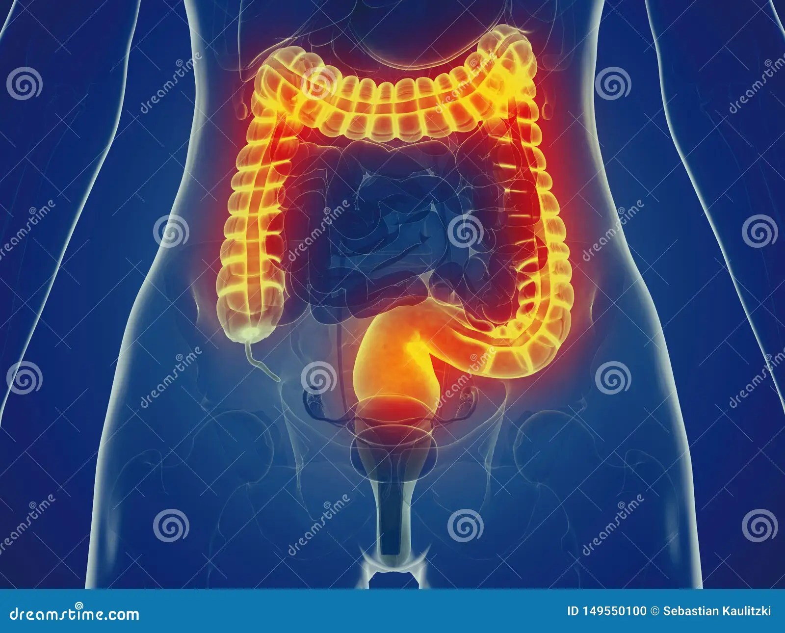 A womans large intestine 库存例证. 插画 包括有 intestine, large