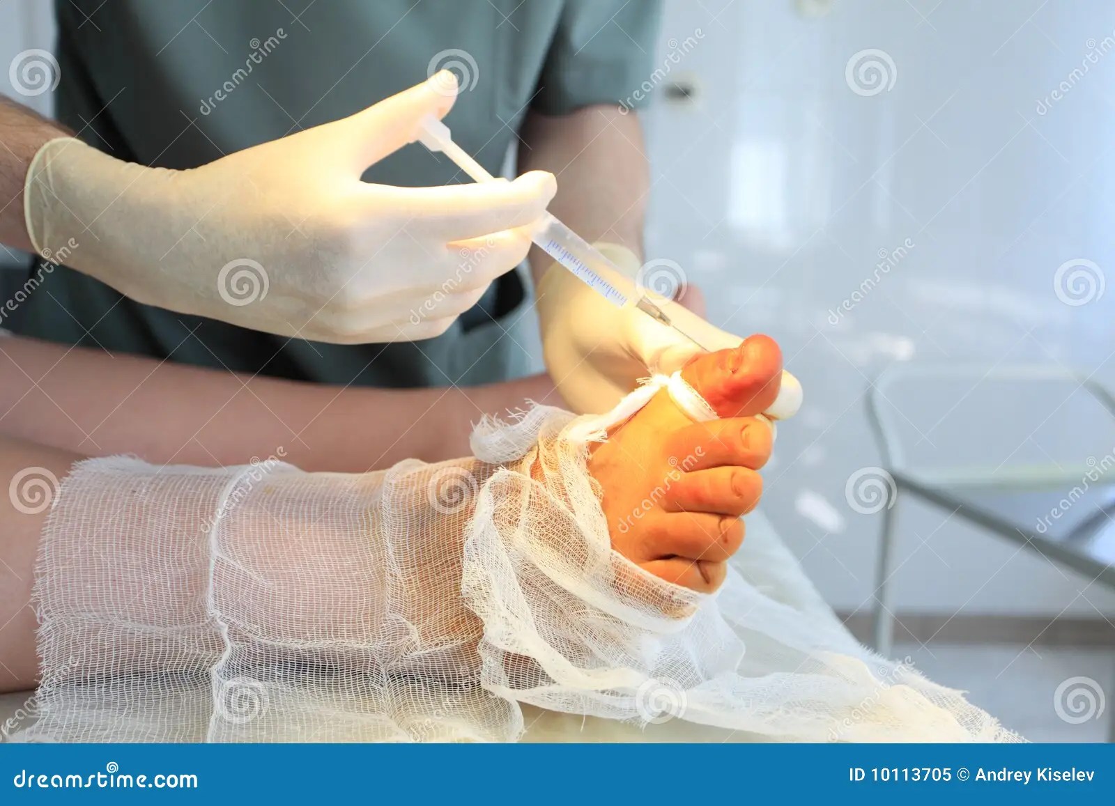 Leg operation stock image. Image of mask, disease, people