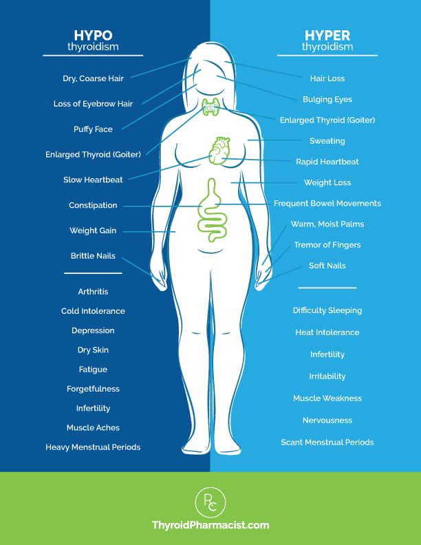 Hyperthyroidism Vs Hypothyroidism Chart