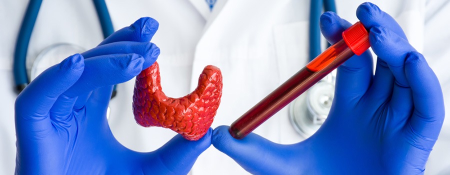 What is considered a normal TSH range? Thyroid Virtual