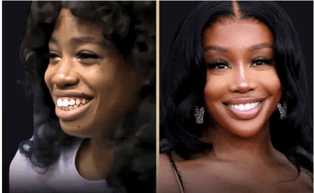 Szas Stunning Transformation The Truth Behind The Plastic Surgery