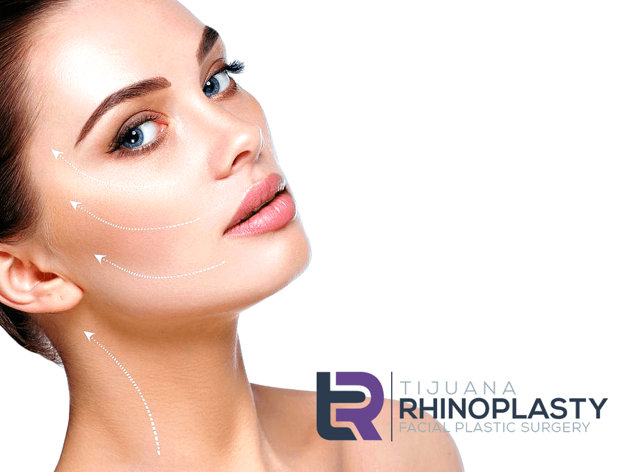 Facelift Tijuana Rhinoplasty Dr. Edgar Eduardo Santos
