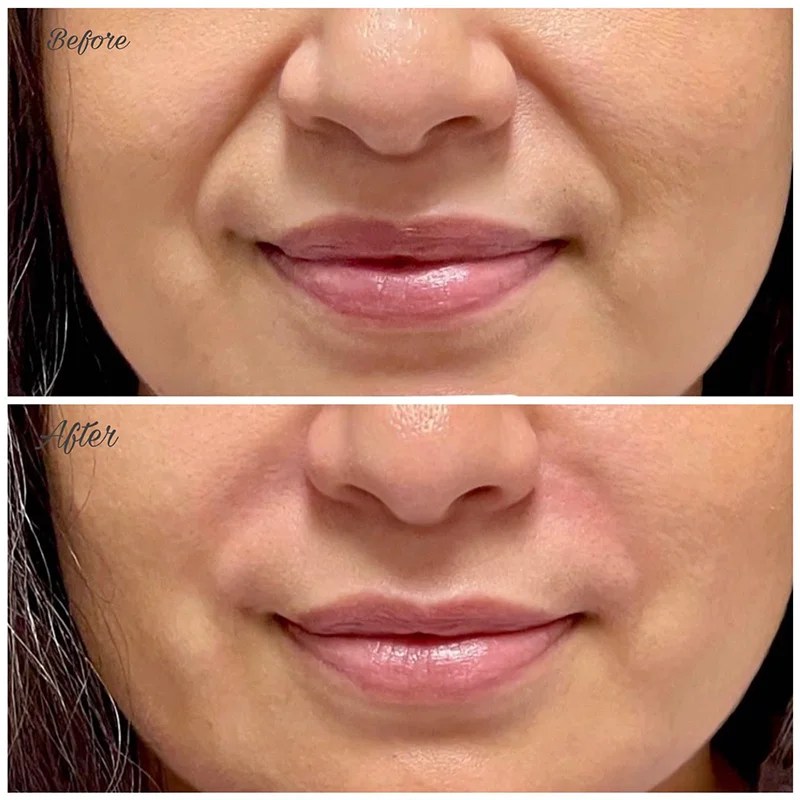 Services Timberline Nails & Spa of Fort Collins, CO 80525 Gel