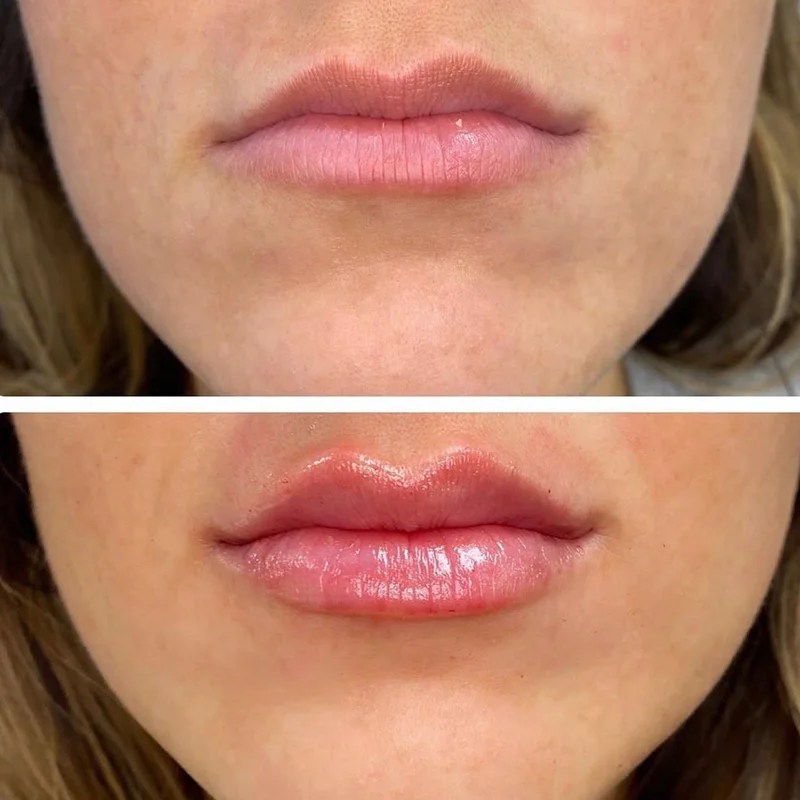 Services Timberline Nails & Spa of Fort Collins, CO 80525 Gel