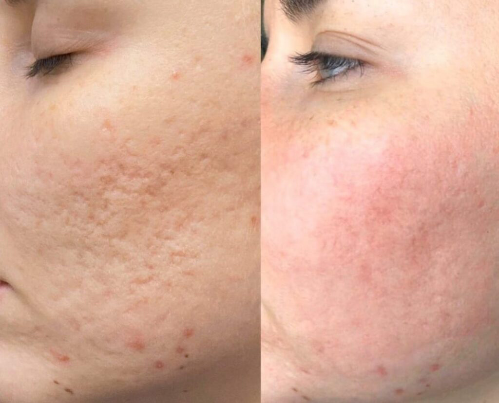 Services Timberline Nails & Spa of Fort Collins, CO 80525 Gel