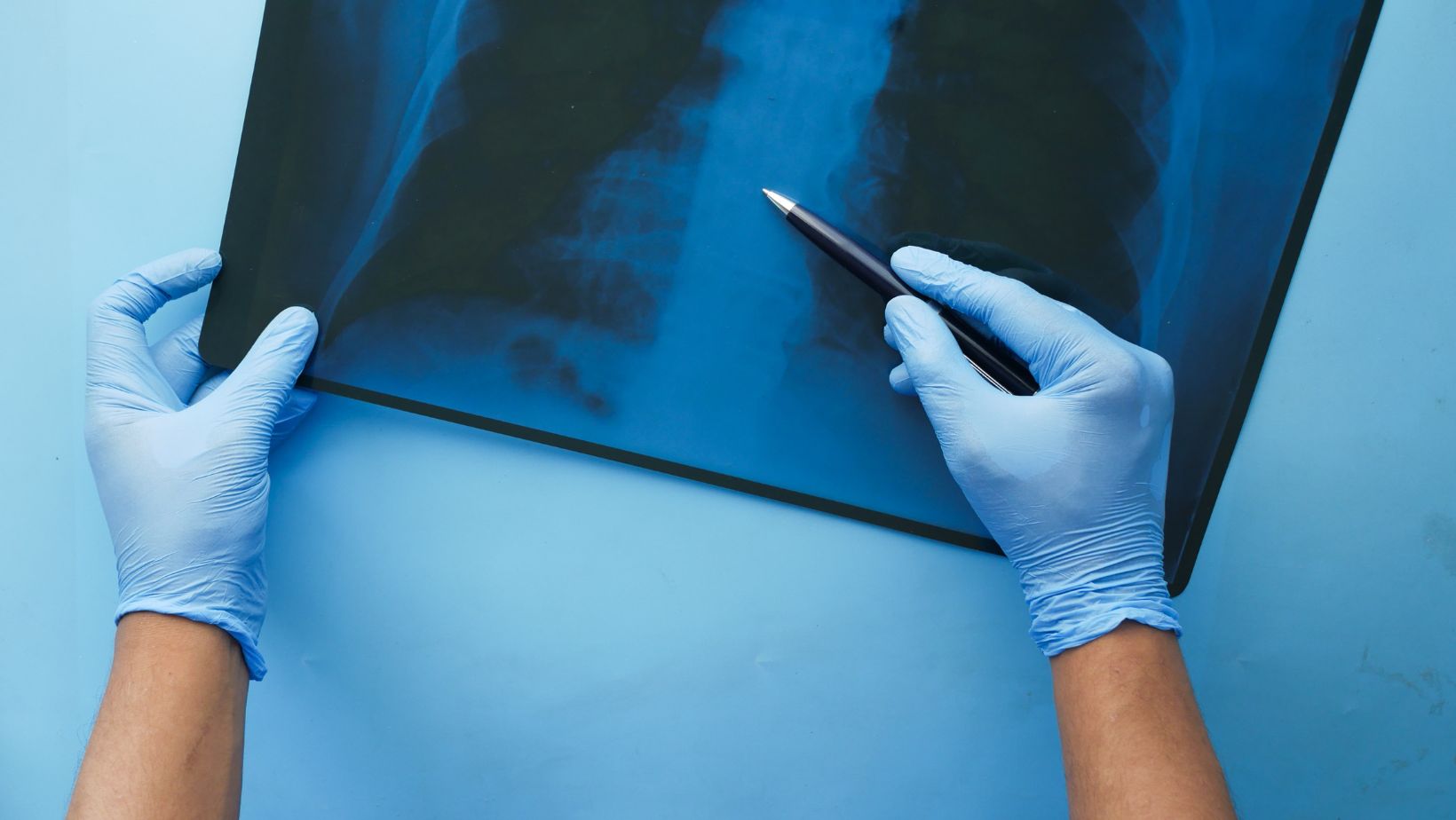 XRay Film Storage Solutions for Healthcare Providers