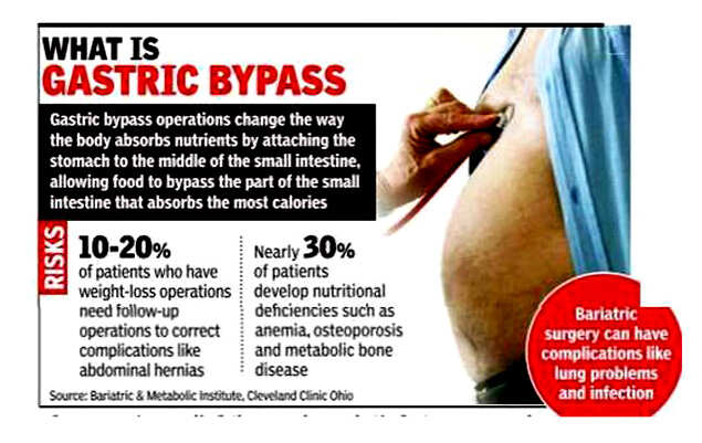 Bariatric Weight Loss Surgery Complications