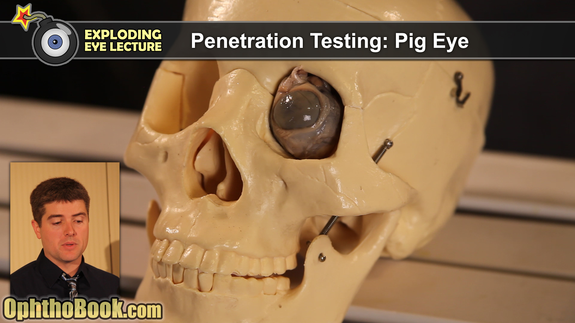 Exploding Eye Lecture (Video)