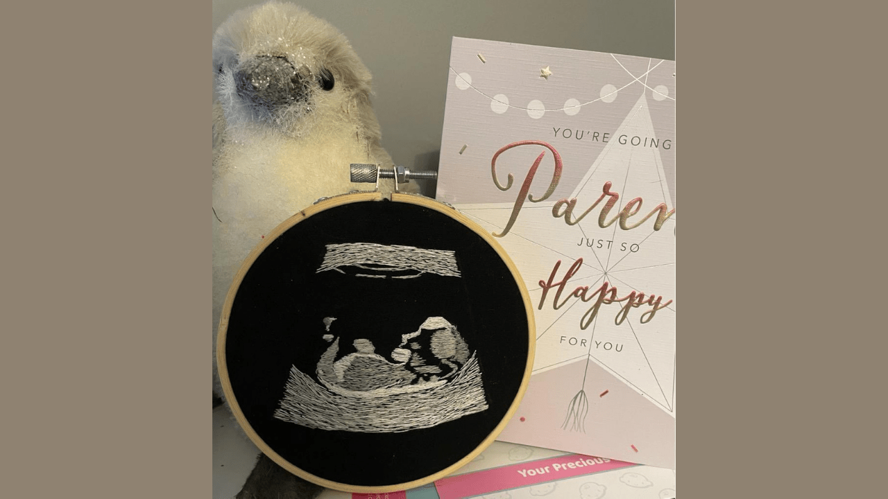 This Ultrasound Let Blind Dad "See" His Baby for the First Time Tinybeans