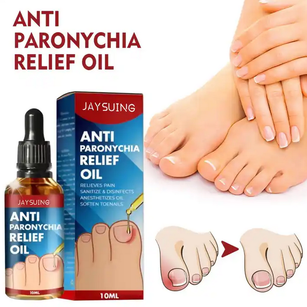 Anti Paronychia Relief Oil Nail Fungus Removal Feet Toe Fungal Care Ointment Price In