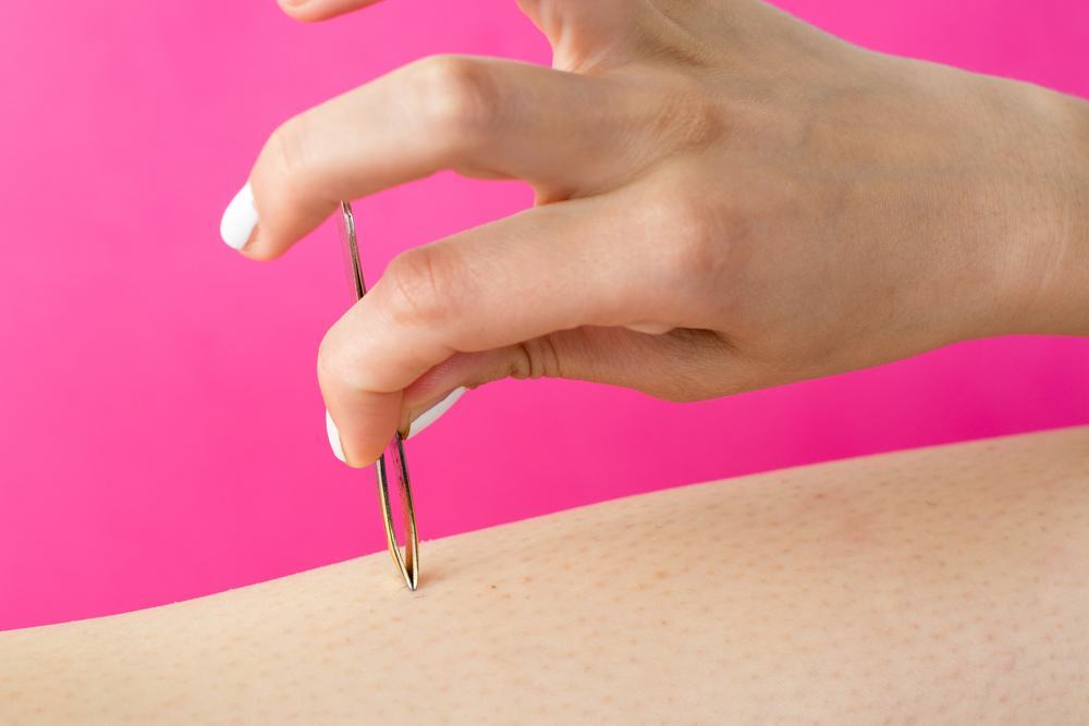 What to Do When You Have Ingrown Hair TipHero