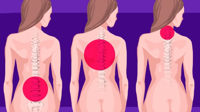 7 Upper Back Pain Causes You Can Easily Fix