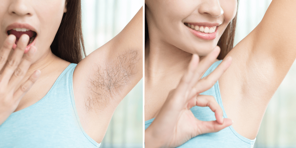 Guide to underarm or armpit hair removal naturally
