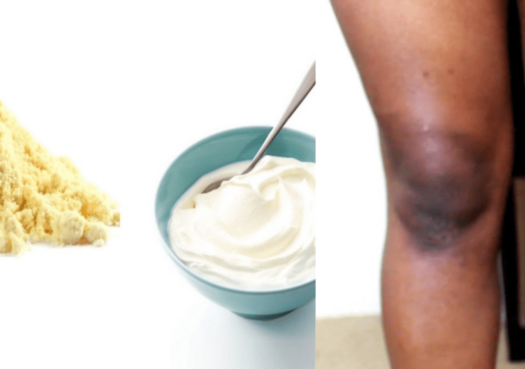 Remove Dark Knee, Elbows and Joints